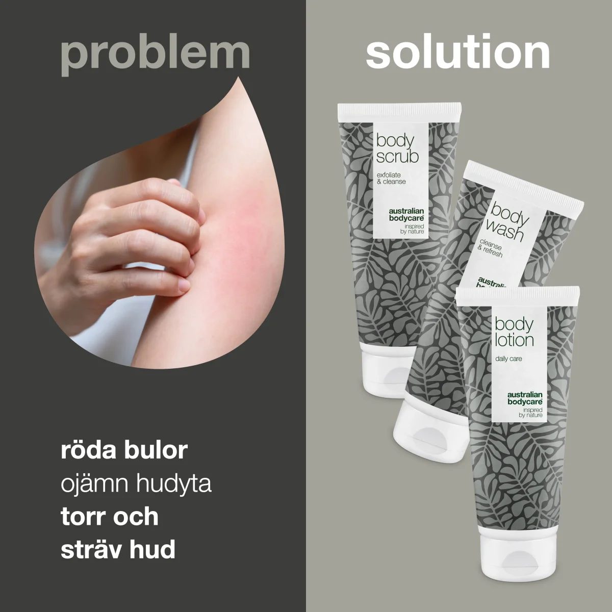 3-pack för keratosis pilaris — minimerar knottrig hud på kroppen som beror på keratosis pilaris - Bild 3