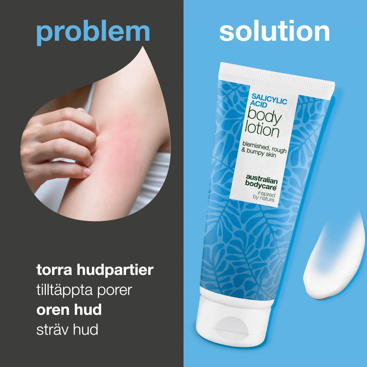 Body Lotion med salicylsyra – för torr och ojämn hud — Body Lotion med salicylsyra exfolierar, återfuktar och hjälper till att mjuka upp torr och ojämn hud. Perfekt för daglig användning. - Bild 3