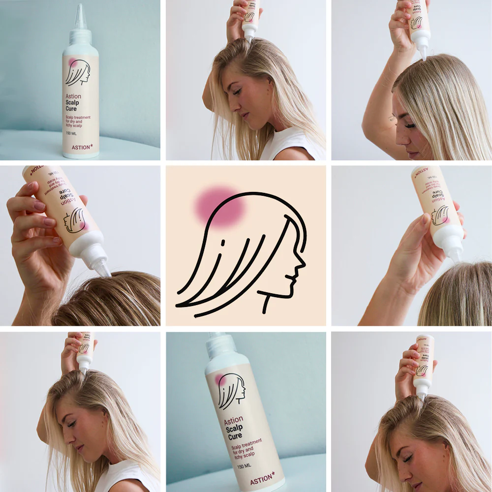 Astion Hårbottenserum — Vård för eksem, psoriasis och kliande, fjällande hårbotten - Bild 7